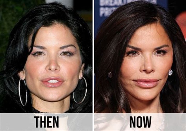 Fran OverWatch Plastic Surgery | Before And After Photos