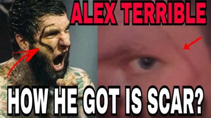 The Behind-the-Scar Journey Of Alex Terrible